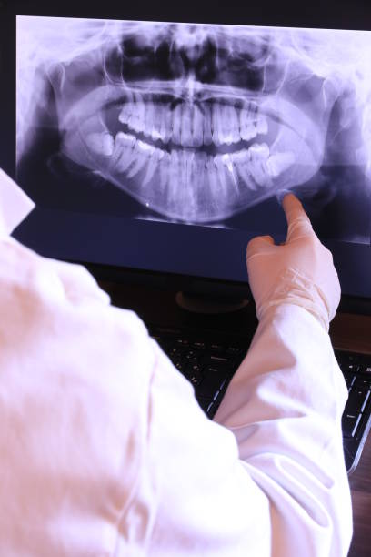 Best Emergency Dentist for Special Needs Patients in Lexington, SC